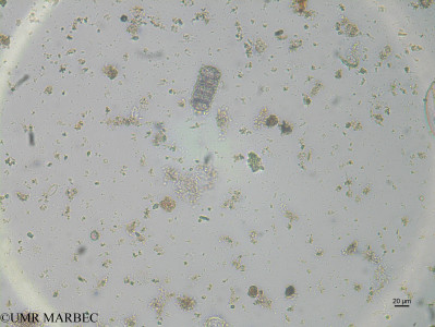 phyto/Brazilian_Nordeste/Northeastcoast_station43/ABRACOS1 October 2015/Paralia sulcata (st40_12_Paralia_sulcata170811_001_ovl)(copy)_thumb.jpg